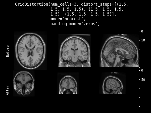 example of GridDistortion