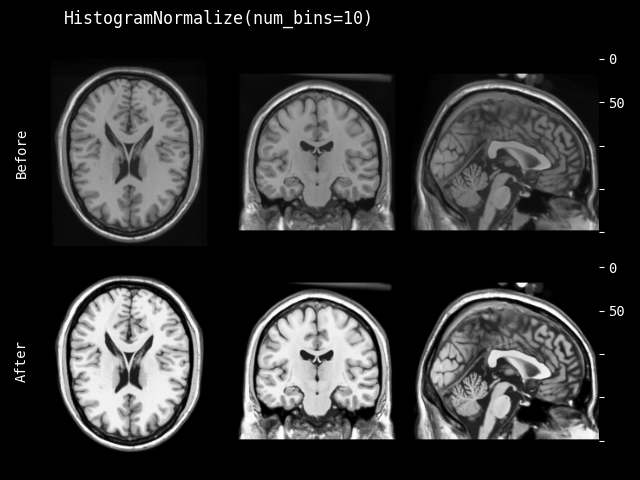 example of HistogramNormalize