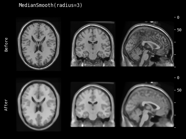 example of MedianSmooth