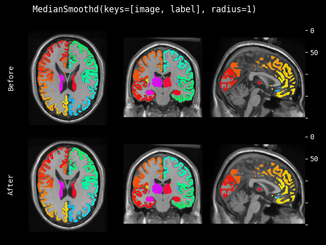 example of MedianSmoothd