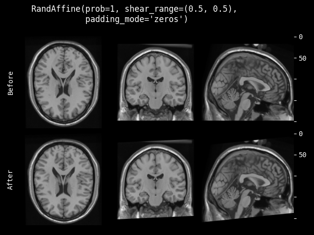 example of RandAffine