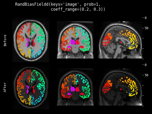 example of RandBiasFieldd