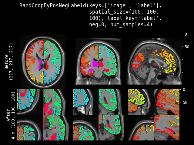 example of RandCropByPosNegLabeld