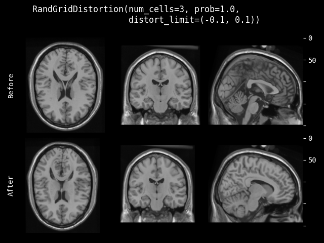 example of RandGridDistortion