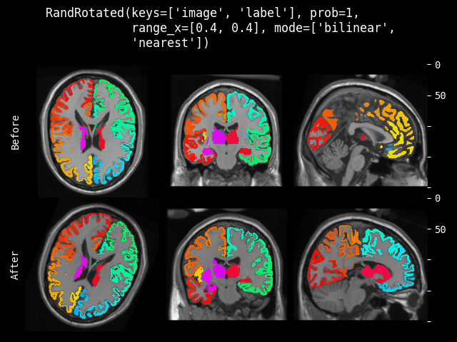 example of RandRotated