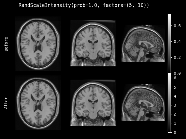 example of RandScaleIntensity