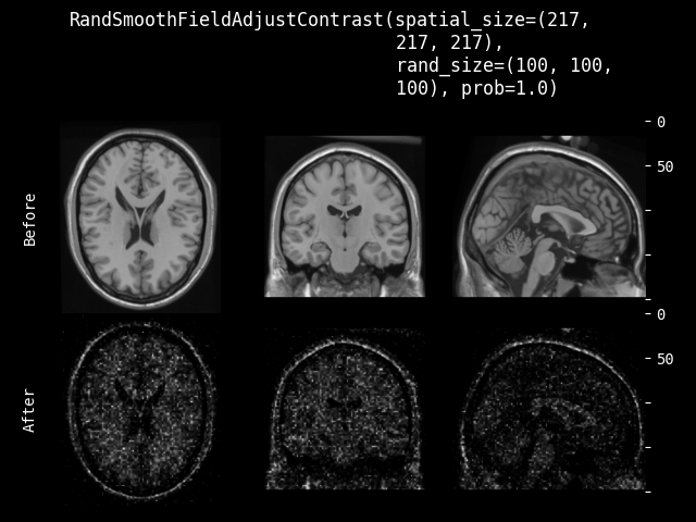 example of RandSmoothFieldAdjustContrast