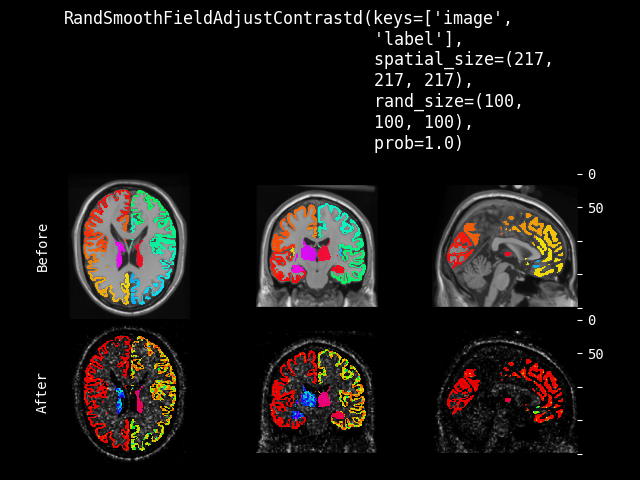 example of RandSmoothFieldAdjustContrastd