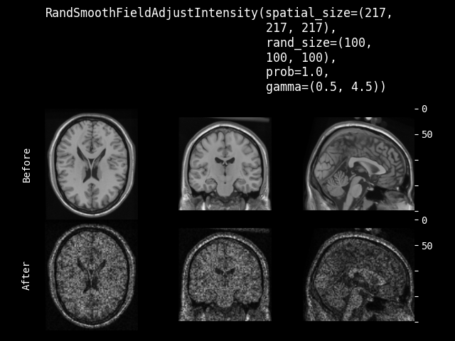 example of RandSmoothFieldAdjustIntensity