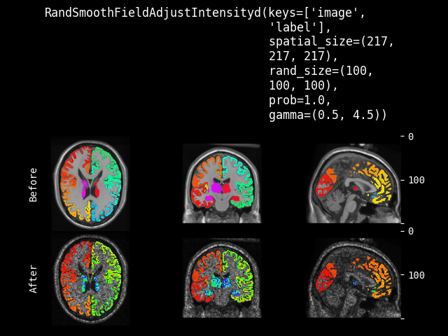 example of RandSmoothFieldAdjustIntensityd