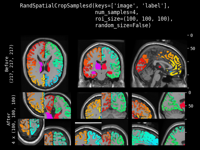 example of RandSpatialCropSamplesd