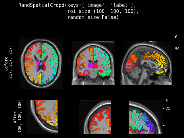 example of RandSpatialCropd