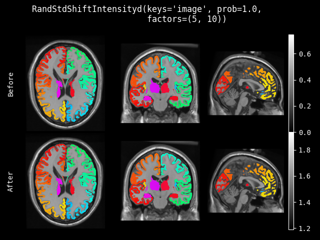 example of RandStdShiftIntensityd