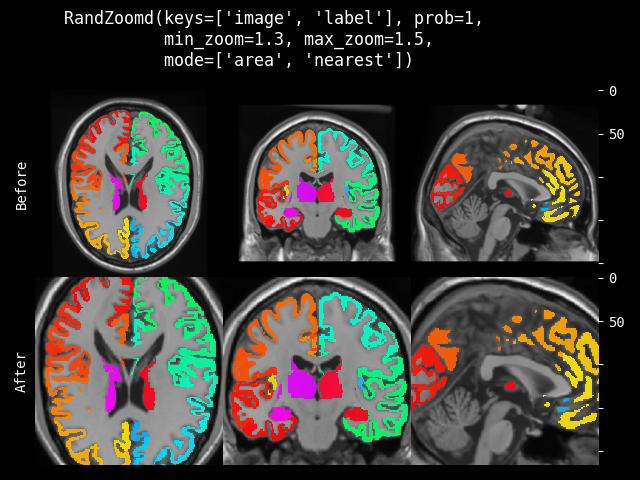 example of RandZoomd