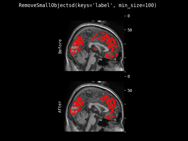 example of RemoveSmallObjectsd
