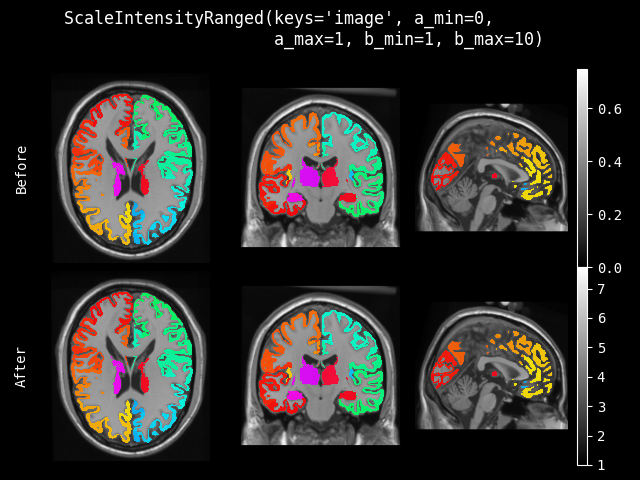 example of ScaleIntensityRanged