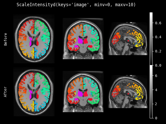 example of ScaleIntensityd