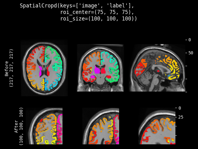 example of SpatialCropd