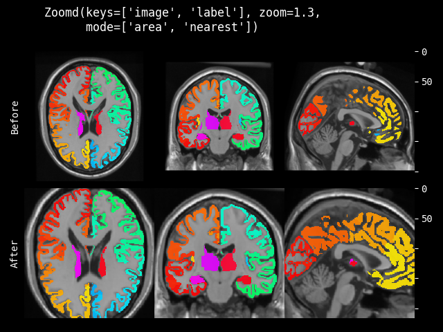 example of Zoomd