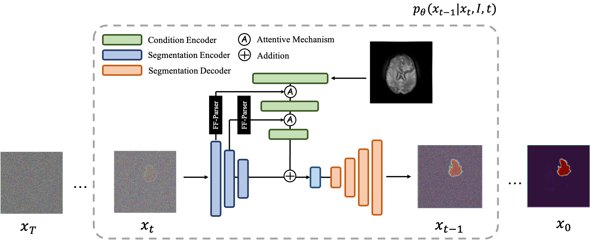 MedSegDiff Overview