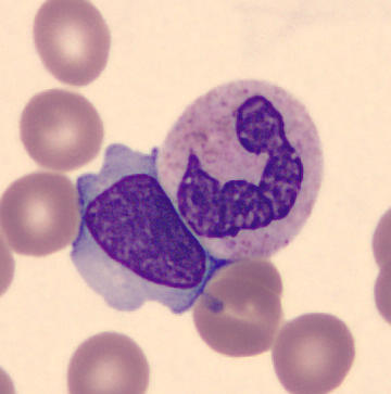 Patient_63/Signed slides/Segmented neutrophils/LY_9355561.jpg