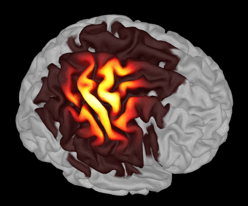 head model parameters